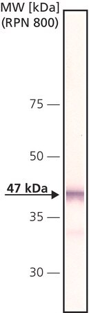 Кроличьи антитела к гликогенсинтазной киназе-3β (GSK-3β)