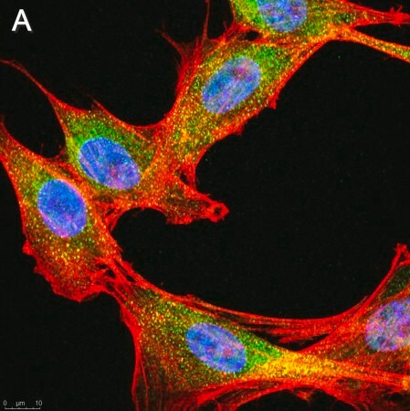 Моноклональное антитело против фосфо-IRE-1α (Ser724) , клон 1M2 ZooMAb® Rabbit