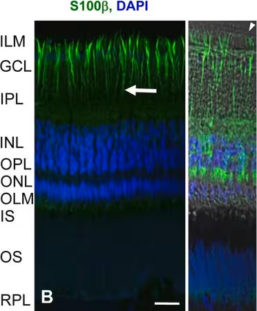 Антитело S100 antibody [SH-B1]